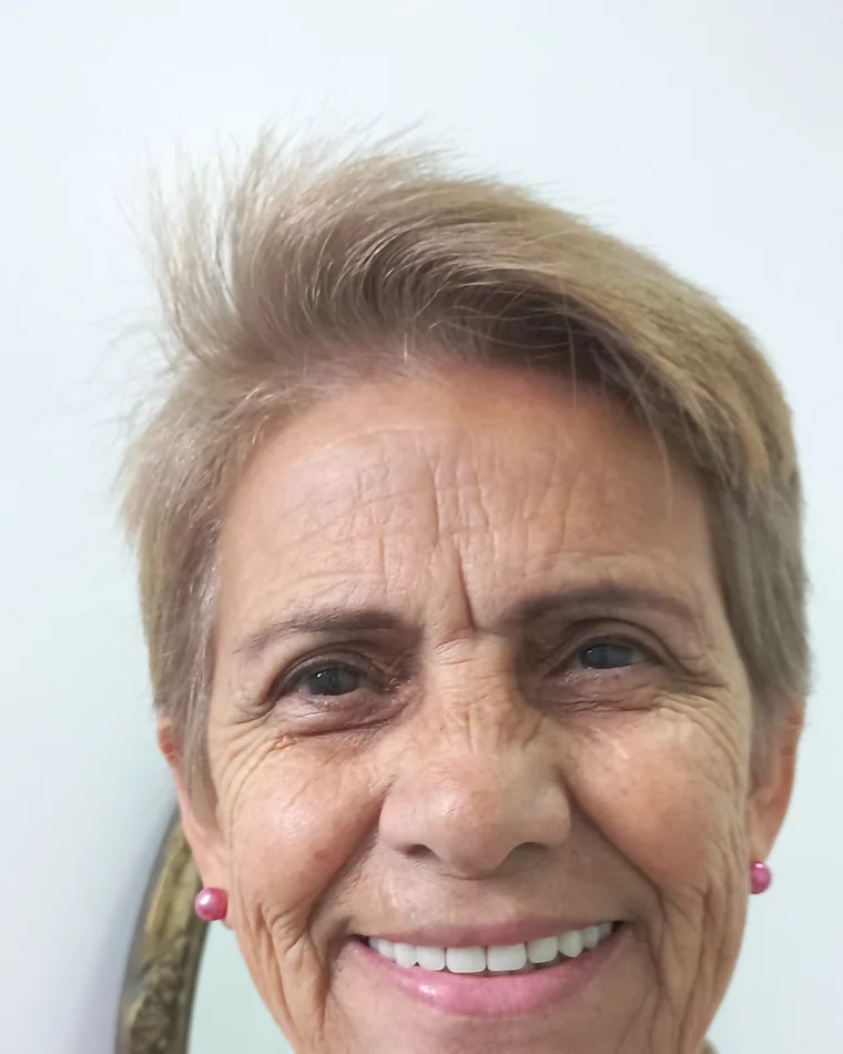 Paciente de J&CR sonriendo con su prótesis nueva